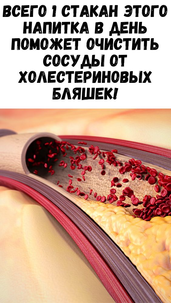 Всего 1 стакан этого напитка в день поможет очистить сосуды от холестериновых бляшек! Всего 1 стакан этого напитка в день поможет очистить сосуды от холестериновых бляшек!