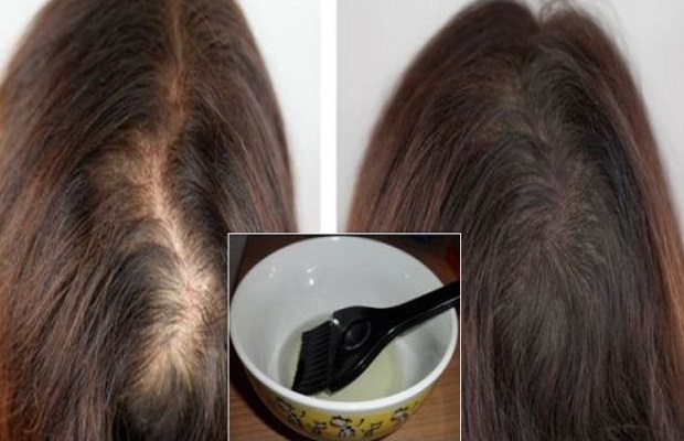 Одно масло, которое остановит выпадение волос и обеспечит рост густых длинных волос всего за 10 дней