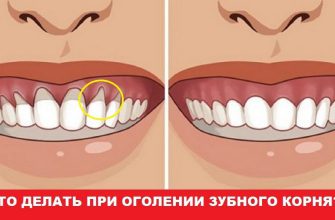 Оголилась шейка зуба? узнай, как вернуть десну обратно!